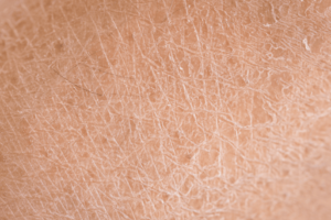 ドクタージャルトのシカクリーム「シカペアクリーム」を塗る前の乾燥した肌